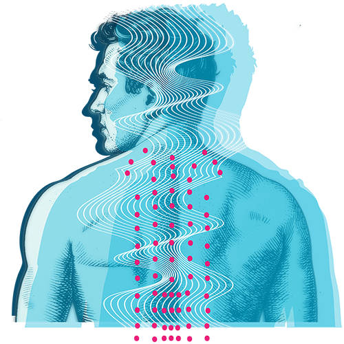 Acupuncture